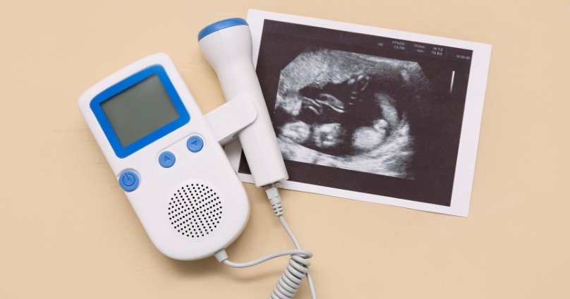 Ultrasound & Doppler