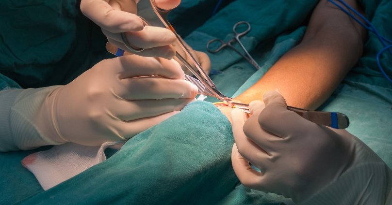 Fistula Salvage Procedure