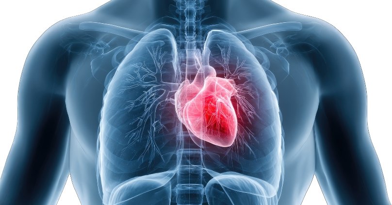 Peripheral Vascular Disease Treatment